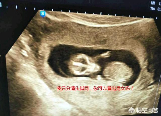 孕妇验血报告怎么看dna_怀孕十二周，腹中胎儿的不同性别有哪些区别