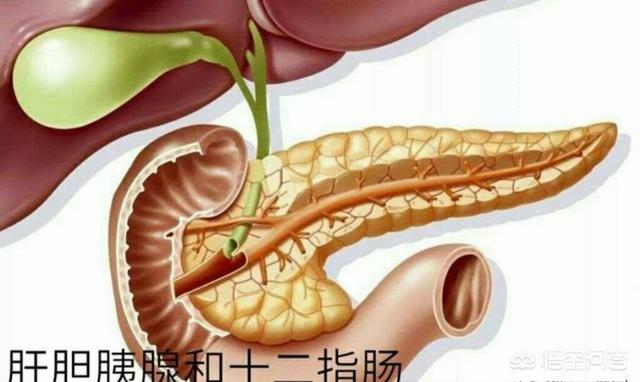 女性慢性胰腺炎的症状:胰管扩张4毫米是慢性胰腺炎吗？