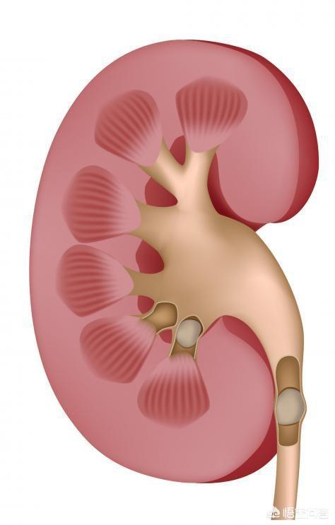 尿结石症状:常吃鱼肝油易患尿结石吗？吃哪些食物能排掉结石？