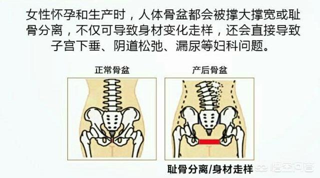 怀孕期间耻骨疼怎么办，怀孕24周，耻骨痛到不能走路怎么办