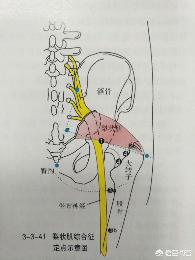 坐骨神经走行解剖图图片