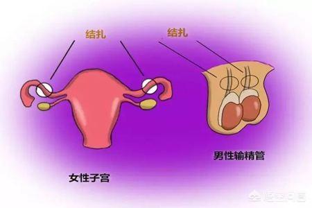 什么是男性绝育手术:老婆易受孕体质，男性结扎对身体有害吗？ 男性绝育手术有什么影响