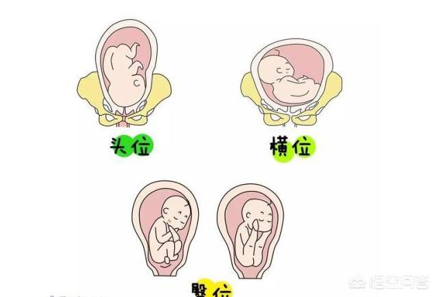 头条问答 - 胎儿入盆为什么头部向下,胎儿不会充血吗?(6个回答)