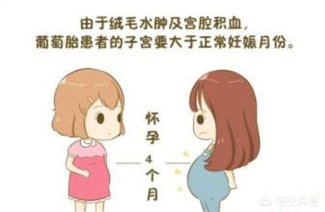 葡萄胎是怎么形成的:去年怀孕时是葡萄胎，手术多久后才能怀孕