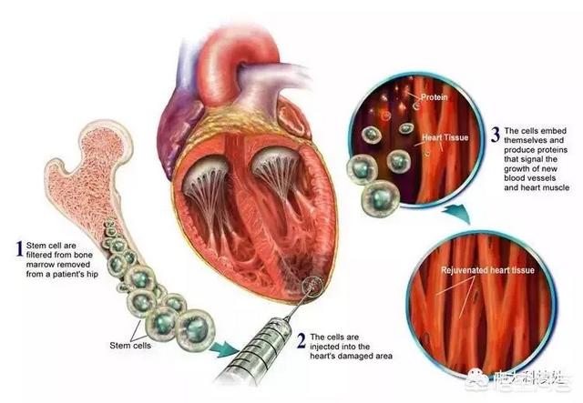 心脏心肌损伤后可以再生吗？为什么？