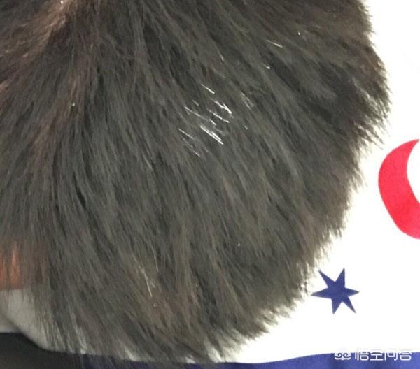 白发是遗传还是血液问题？