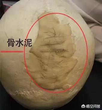 什么脸型才最耐看，什么样的脸才能被称为“高级脸”？