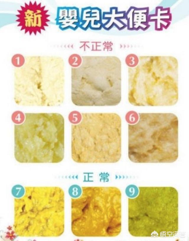 婴儿母乳乳糖不耐受的症状表现:母乳喂养，一天拉一次，但是有奶瓣，是不是乳糖不耐受？
