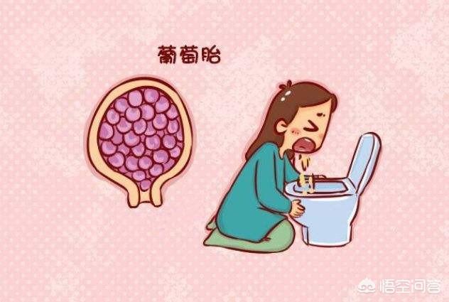 葡萄胎是怎么形成的:去年怀孕时是葡萄胎，手术多久后才能怀孕