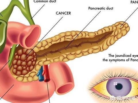 消化系统常见疾病检测:消化系统常见疾病的诊治 肚子痛检查淀粉酶有什么作用？