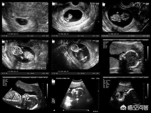 怀孕周期图:怀孕周期图片 胎儿 怀孕到生孩子，共274天正常吗？