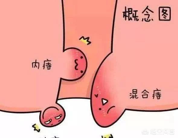 拉血是怎么原因(泻血是什么原因)