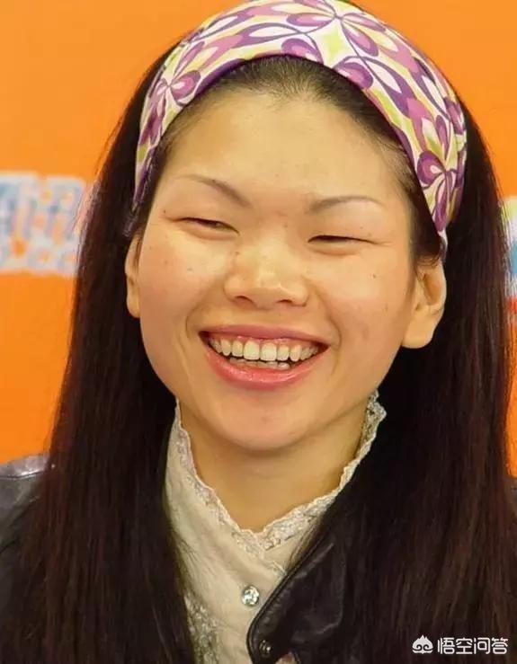 雀斑和黄褐斑:女性长黄褐斑一般和哪些病有关系
