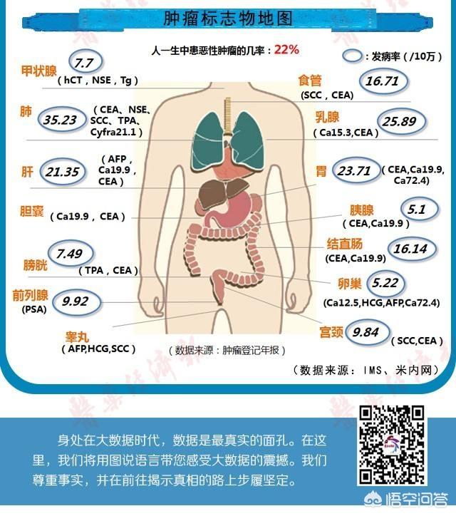 头条问答 癌胚抗原正常 能不能说明没有患肺癌 34个回答