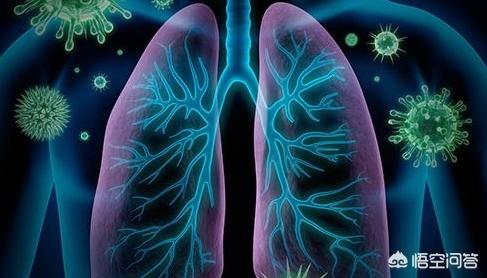 关于肺炎患者的护理;肺炎患者的护理问题及护理措施