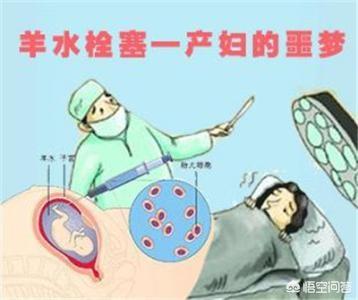 肩难产:肩难产的七步处理方法 生小孩是剖腹产好还是顺产好？为甚么？