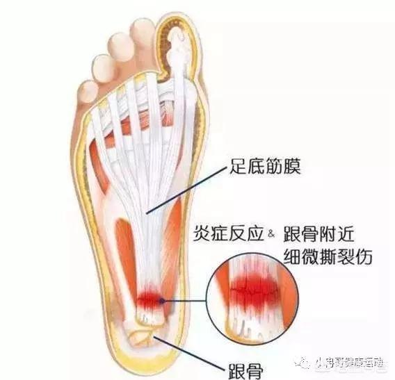 女生尾巴根疼是什么原因:男孩尾巴根疼是什么原因 引起足跟痛的原因是什么？