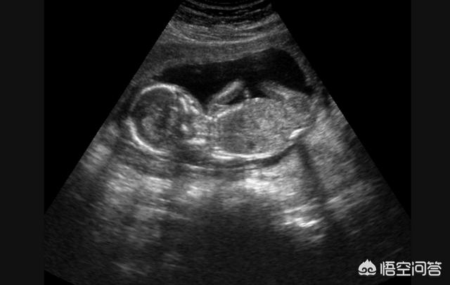 什么时候可以感受到胎动，现在怀孕15周了，可以感受到胎动了吗
