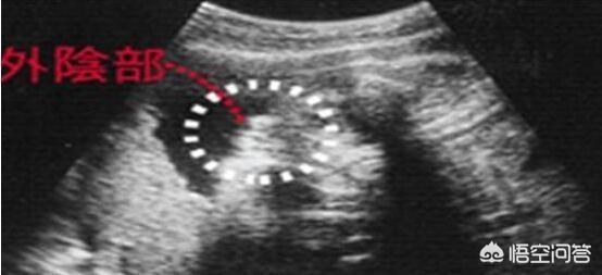 超典型的男宝特征，16周胎儿男女生殖器还能看出来了的吗