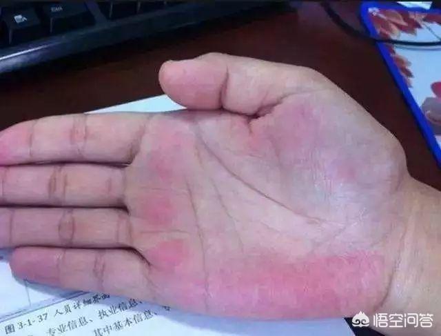 花清丹滋养型有排泄物:肝不好，会有“2处发臭”，“3处变色”，具体指哪里？
