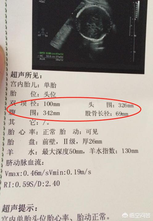 头条问答 宝宝腹围比头围大 正常吗 11个回答