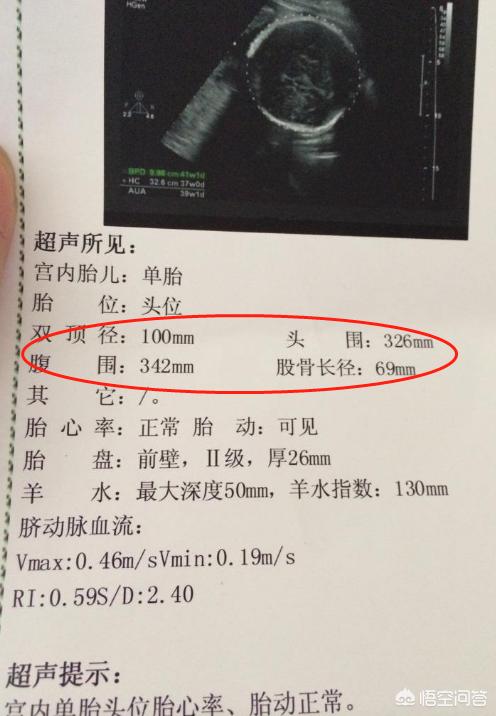 头条问答 宝宝腹围比头围大 正常吗 11个回答