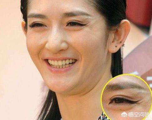 眼睛周围的皱纹都是鱼尾纹吗？
