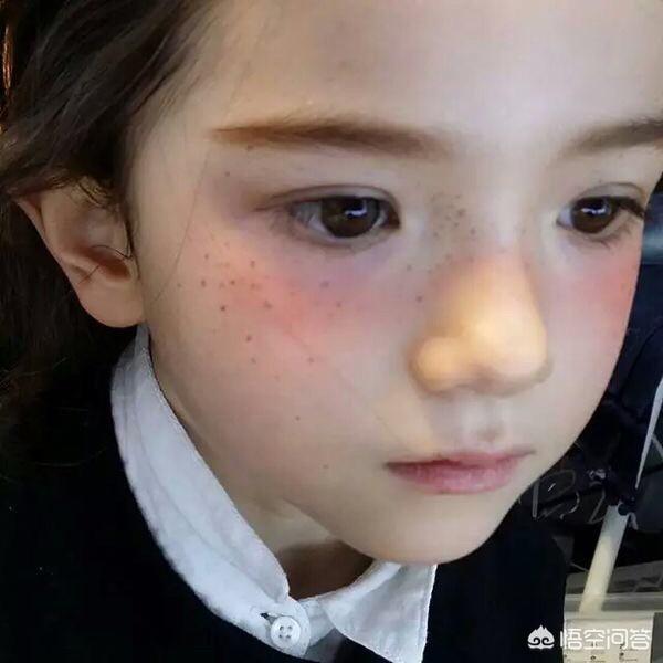 头条问答 - 我侄女今年14岁,脸上长了好多小斑是怎么回事,有什么小孩