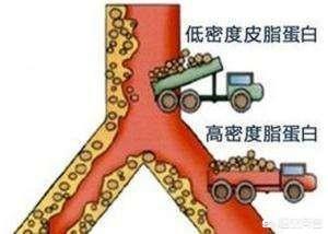 美国深海鱼油的功效:深海鱼油真的能降血脂吗？
