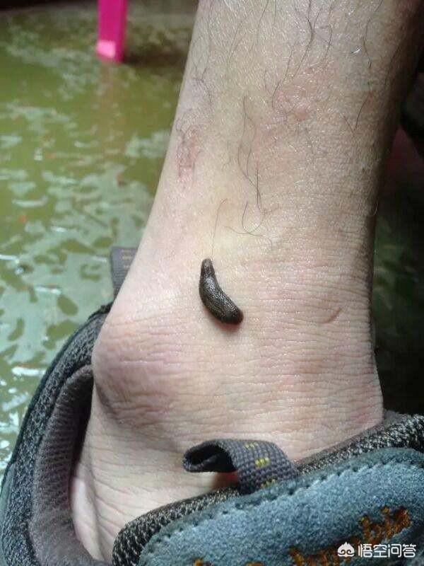 今天插秧时蚂蟥粘脚上了,有什么好办法把蚂蟥弄下来?