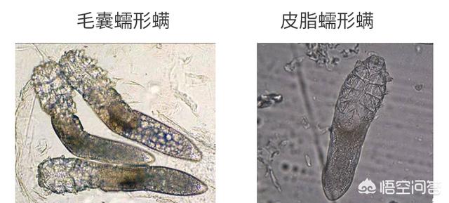 毛囊虫的原因是什么:毛囊虫是什么原因引起的 从痘痘里挤出来的白色液体是螨虫尸体吗？求大神指教？