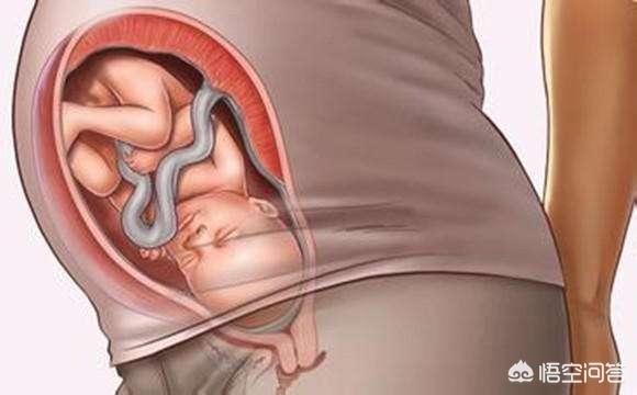 孕期怎样判断宝宝是否健康？ 宝宝健康 第3张