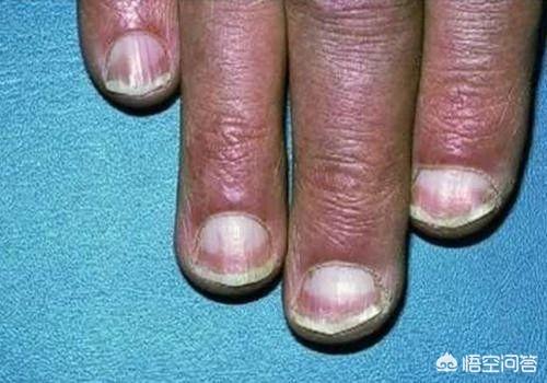 壮阳手指安摩法图，经常用手揉腰，对身体有什么好处？