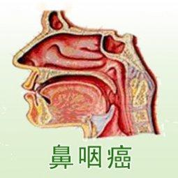 金宇彬的鼻咽癌能好吗:金宇彬的鼻咽癌是不治之症吗有康复的可能吗