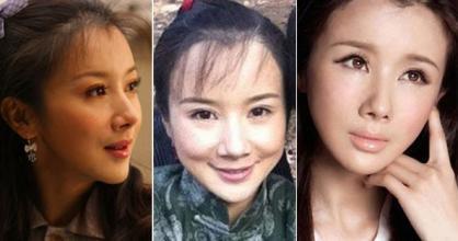 戚薇整容过吗:你认为有哪些天生丽质却被整容害苦的女星？