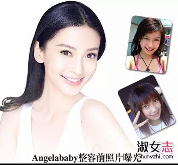 哪个明星整容嫌疑最大？