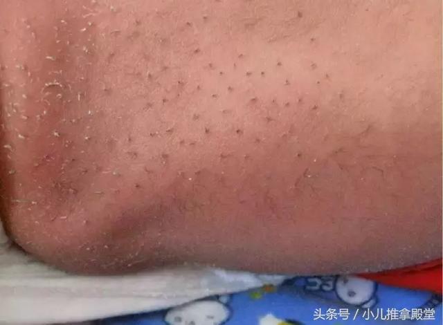 丁芯:孩子睡觉总不踏实，该怎么办？