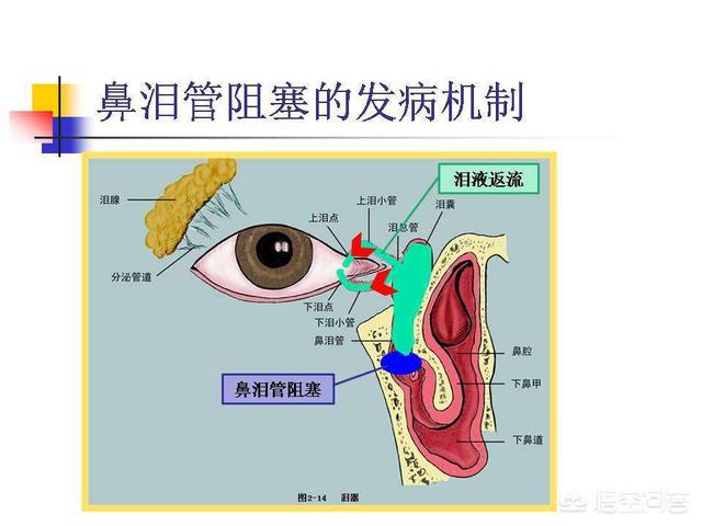 四个月婴儿眼白有血丝有眼屎:宝宝的眼睛总是流泪而且有眼屎，这是怎么回事？