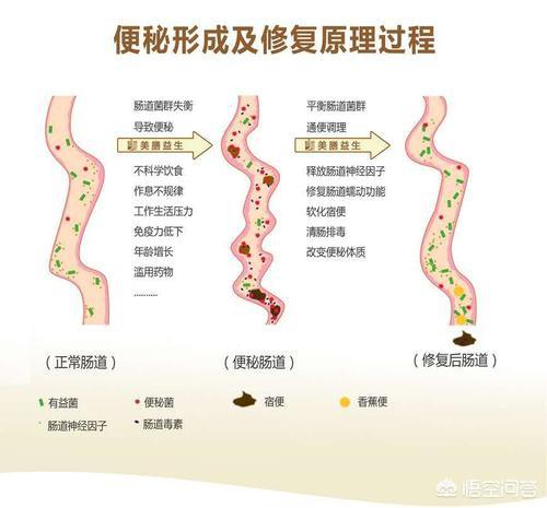 大便入水就散开是怎么回事;大便入水就散是什么原因