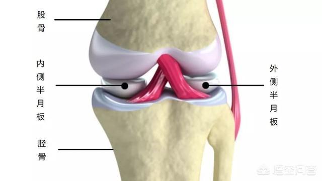 腿响是怎么回事:膝关节响是怎么回事？是膝关节炎吗？