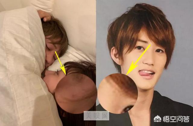 罗霈颖整容对比照:如何看待私生整容后追到爱豆这件事？