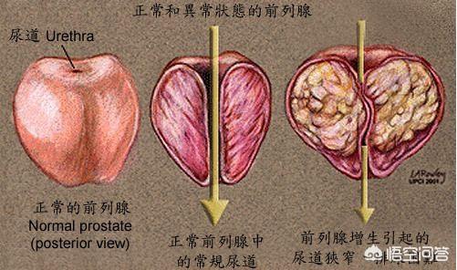 生殖器保健(生殖器保健是什么)