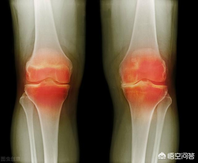 膝盖响是什么原因,膝盖里面响，是什么原因呢？
