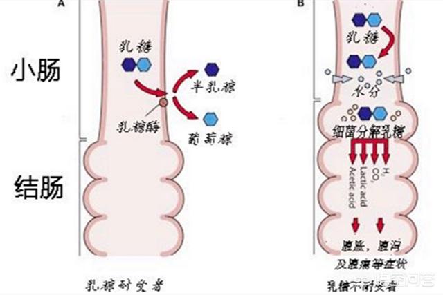 乳糖不耐受宝宝最常见的症状有哪些？插图33