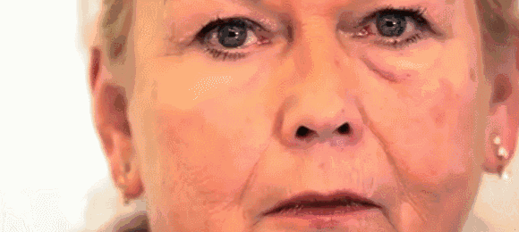 眼袋该怎么办(突然发现有眼袋了怎么办)