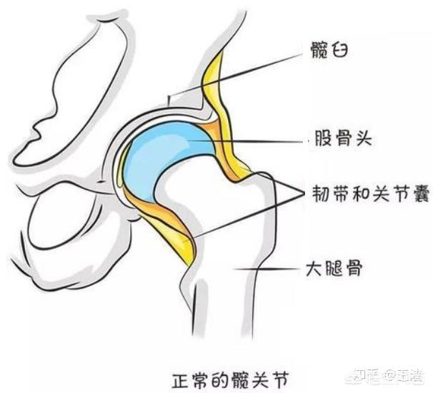 胯关节发育不良:什么是成人髋关节发育不良？