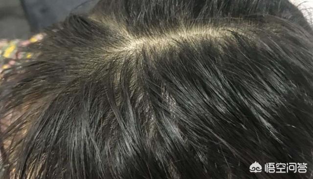 夏天头皮超级油,有没有什么清爽去油能力强的洗发露？