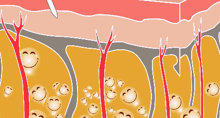 肌肉腿可以抽脂吗:大腿抽脂吸脂是什么体验？