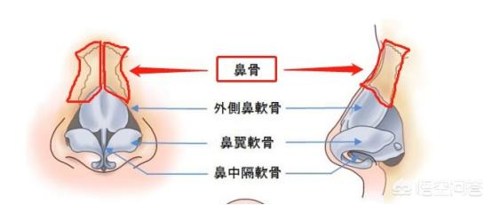 头条问答 鼻子太宽 如何改善 变美军师的回答 0赞
