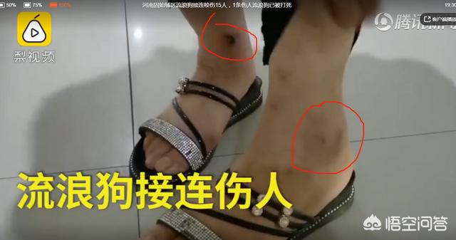 疯狗咬人后人学狗叫:为什么河南固始疯狗咬人伤者升至15人？